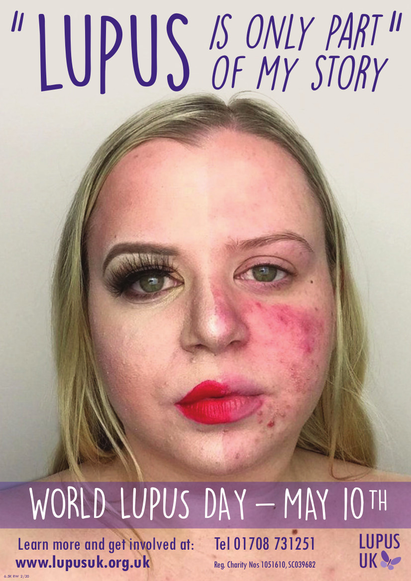 Exclusive Beth Does Beauty Founder Talks About Her Lupus Diagnosis For